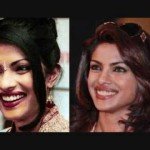 Priyanka_Chopra_Nose Job